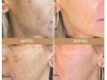 amostra-gratis-rejumax-rejuvenescedor-facial-small-2