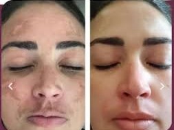 amostra-gratis-rejumax-rejuvenescedor-facial