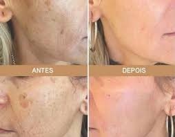 amostra-gratis-rejumax-rejuvenescedor-facial-big-2