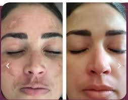 amostra-gratis-rejumax-rejuvenescedor-facial-big-0