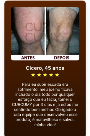 curcumy-combate-as-dores-articulares-e-do-corpo-big-1