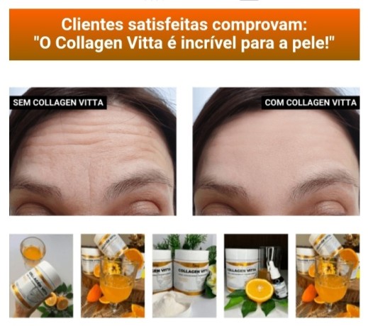 collagen-vitta-diga-adeus-a-flacidez-e-rugas-sua-beleza-de-dentro-para-fora-big-2